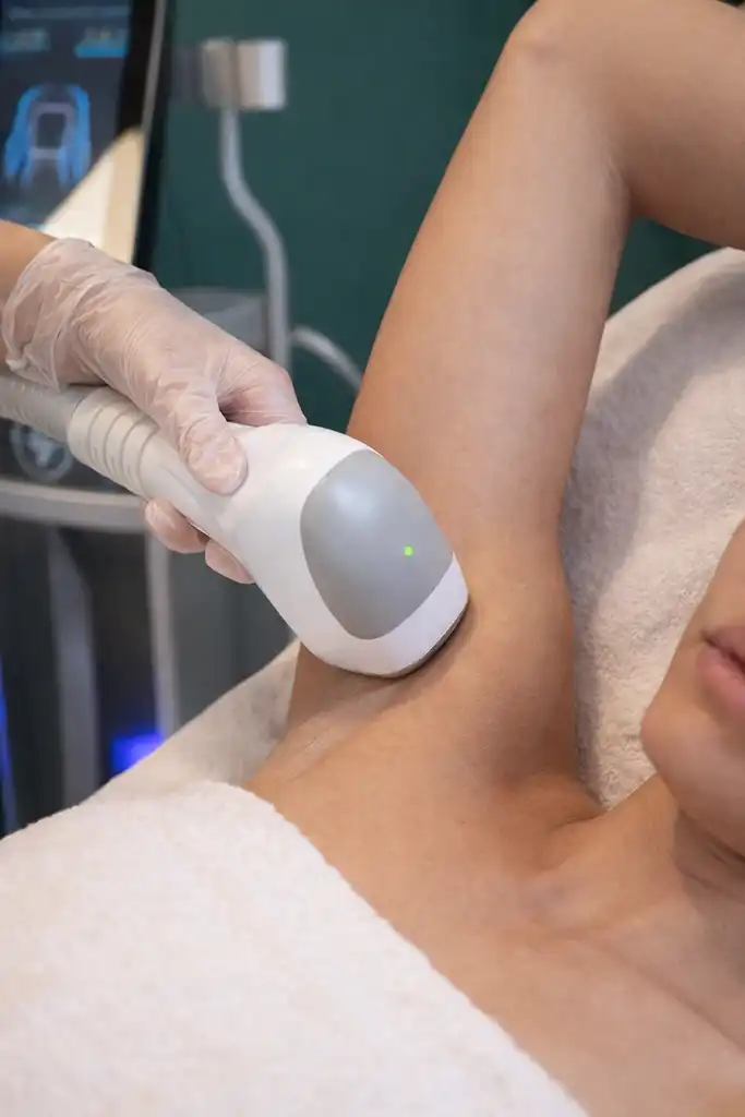 Epilation définitive au laser suprem 300