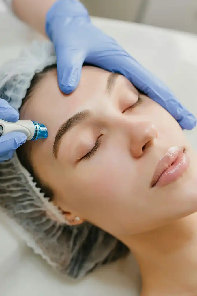 Épilation laser visage